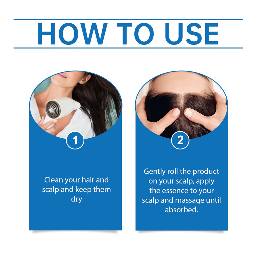 25Mlhair Care Serum Roll-On Prevent Hair Loss Baldness Scalp Massage Repair Dry Damaged Hair 3% Rosemary Nourishing Hair Essence